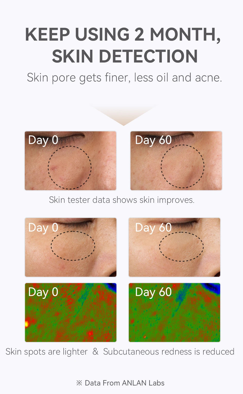 New LED Beauty Mask – Photon Energy Skin Rejuvenation