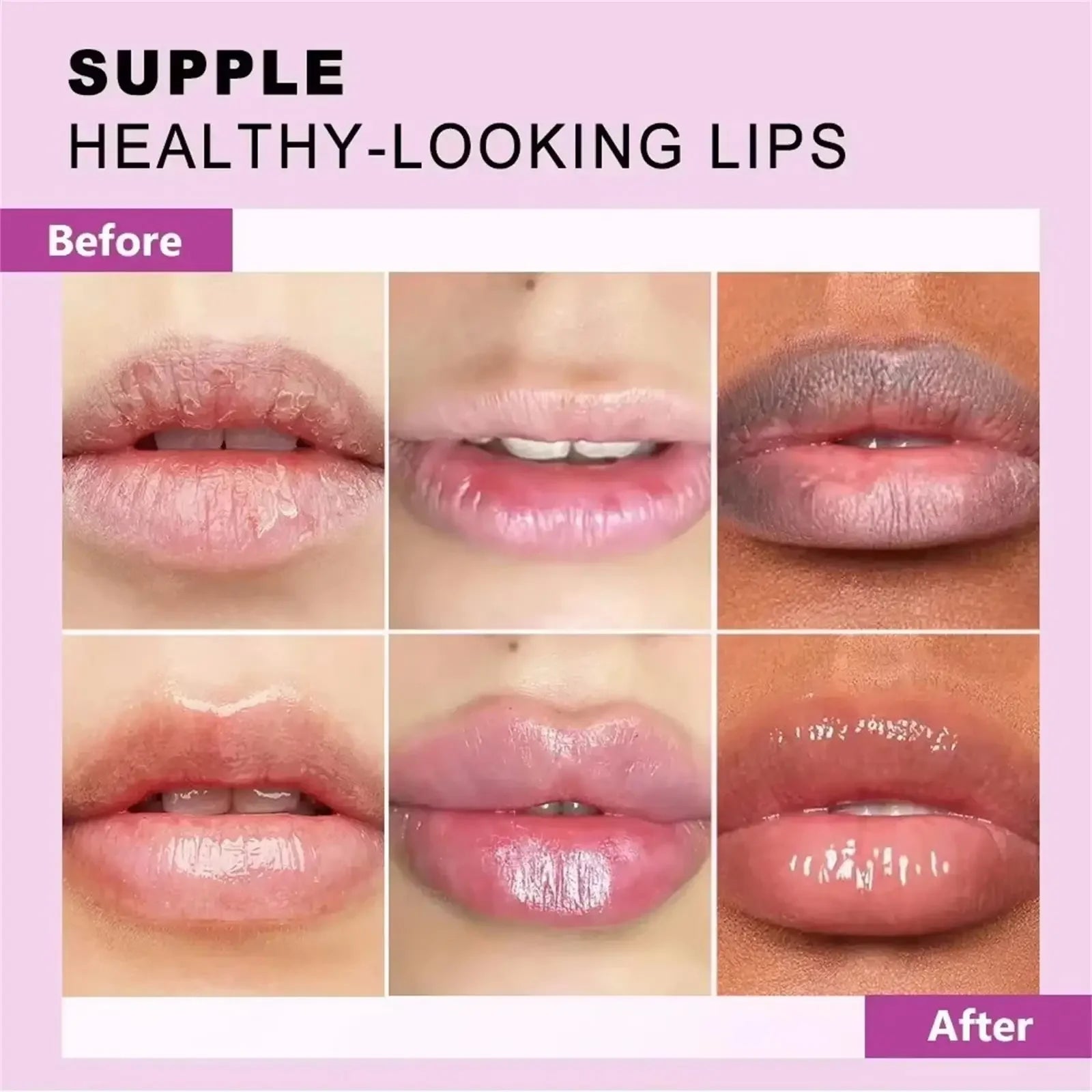 Natural Lip Plumping