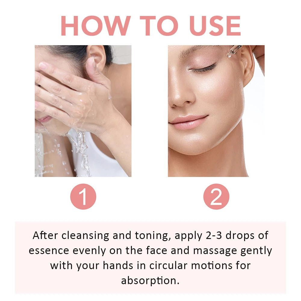 ToneFix Serum – Melasma & Dark Spot Corrector