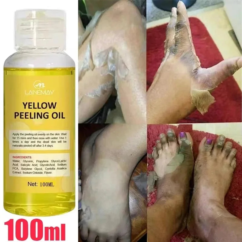 Extra Strength Yellow Peeling Oil