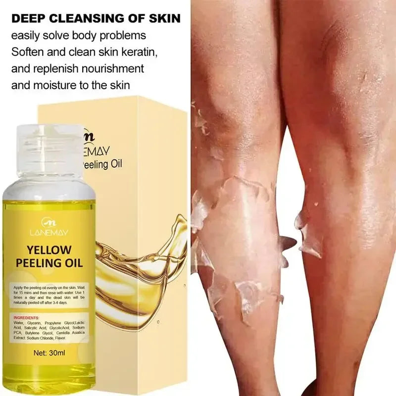 Extra Strength Yellow Peeling Oil