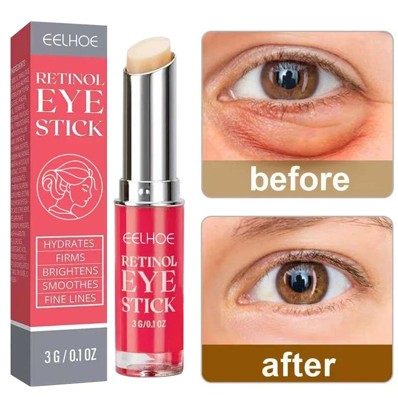 Anti-Wrinkle Eye Cream