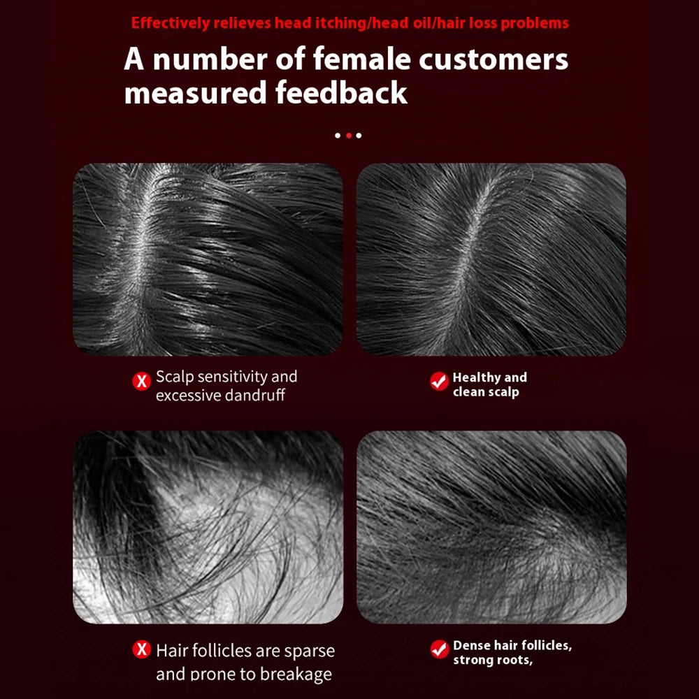 Scalp Therapy Hair Massage Comb