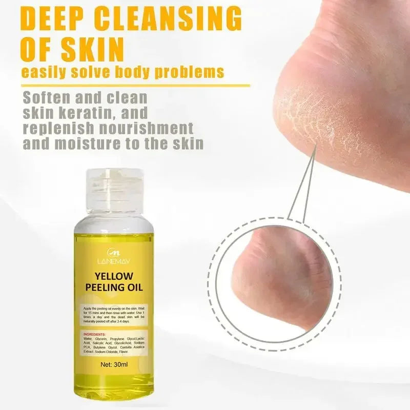 Extra Strength Yellow Peeling Oil