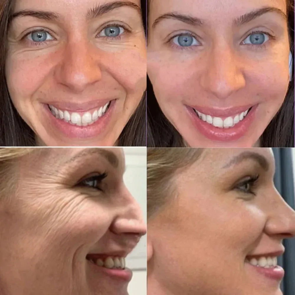 Retinol Anti-Wrinkle Face Serum