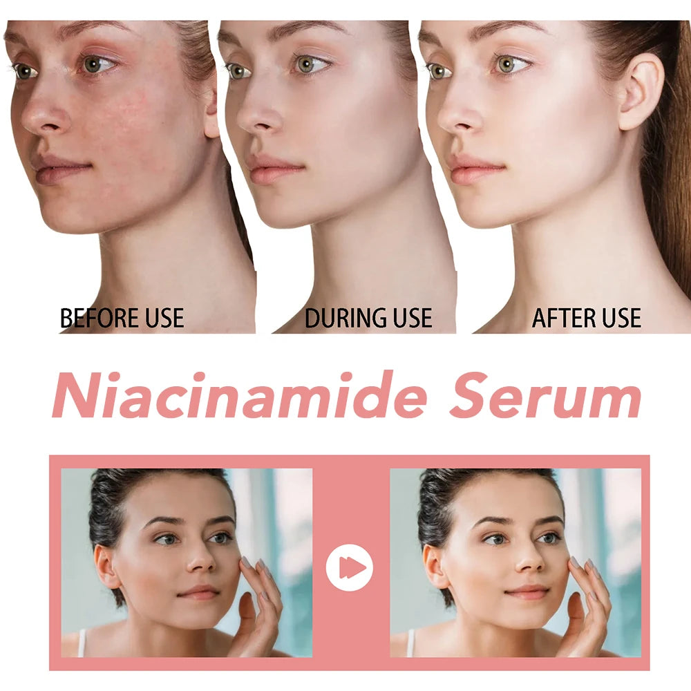 ToneFix Serum – Melasma & Dark Spot Corrector
