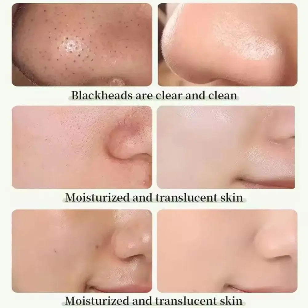 ClearSkin Mud Mask Stick – Oil Control + Deep Clean
