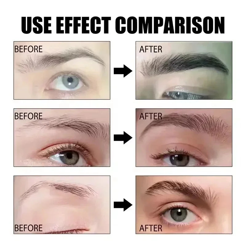 Eyelash &amp; Eyebrow Growth Serum