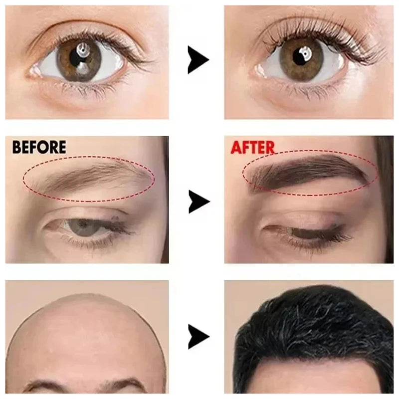 Eyelash &amp; Eyebrow Growth Serum
