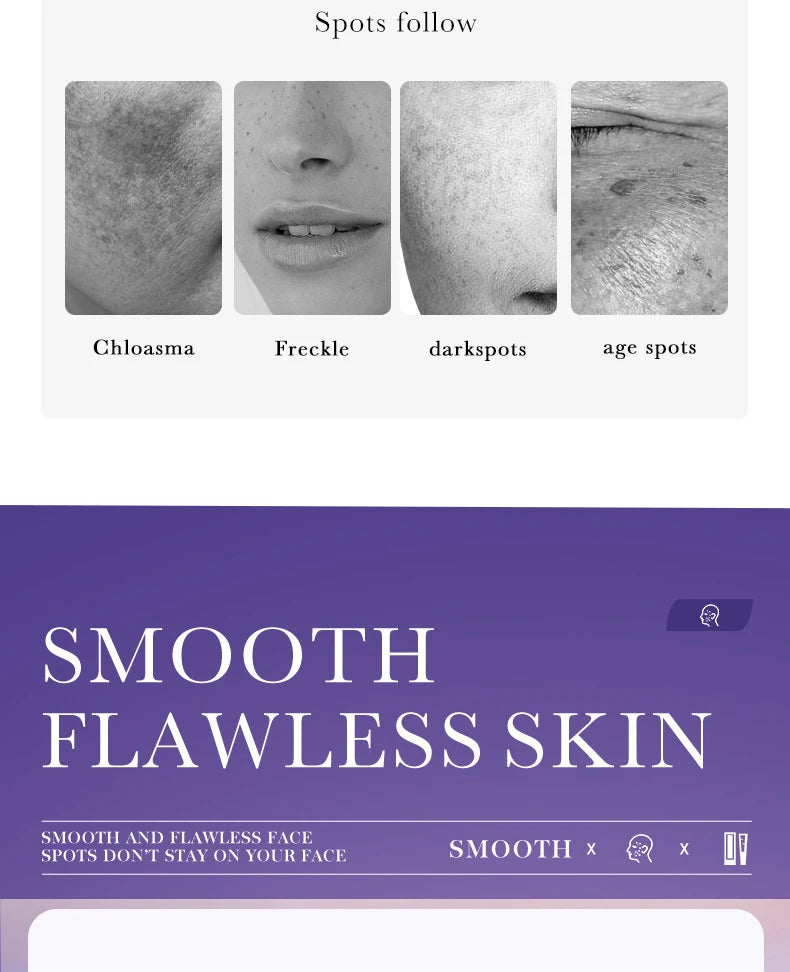 Freckle Removing Nicotinamide Face Cream