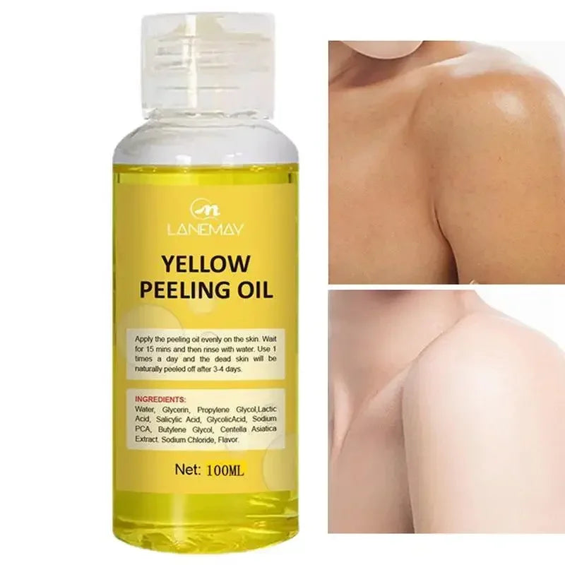 Extra Strength Yellow Peeling Oil