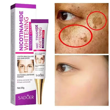 Freckle Removing Nicotinamide Face Cream