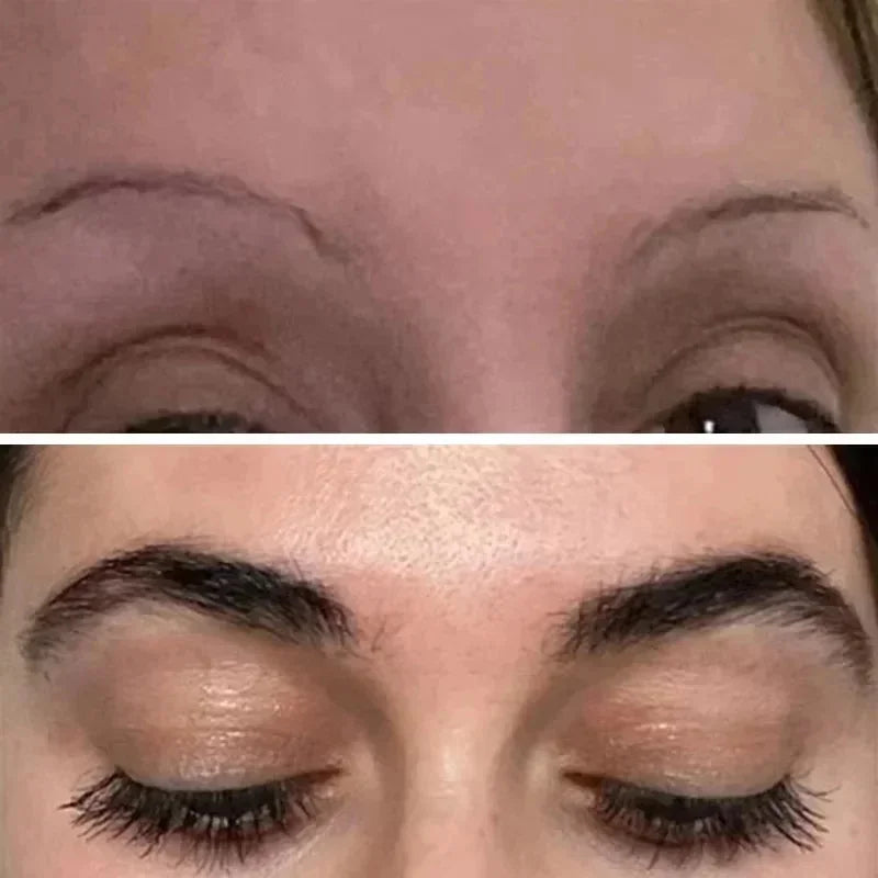 Eyelash &amp; Eyebrow Growth Serum