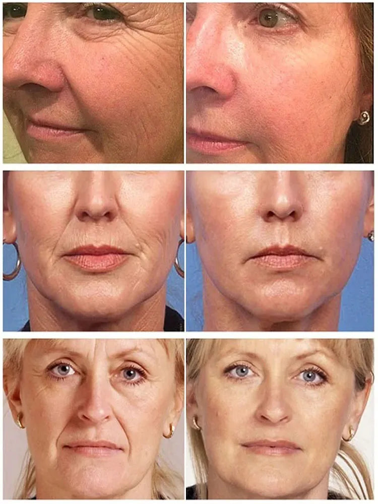 Retinol Anti-Wrinkle Face Serum