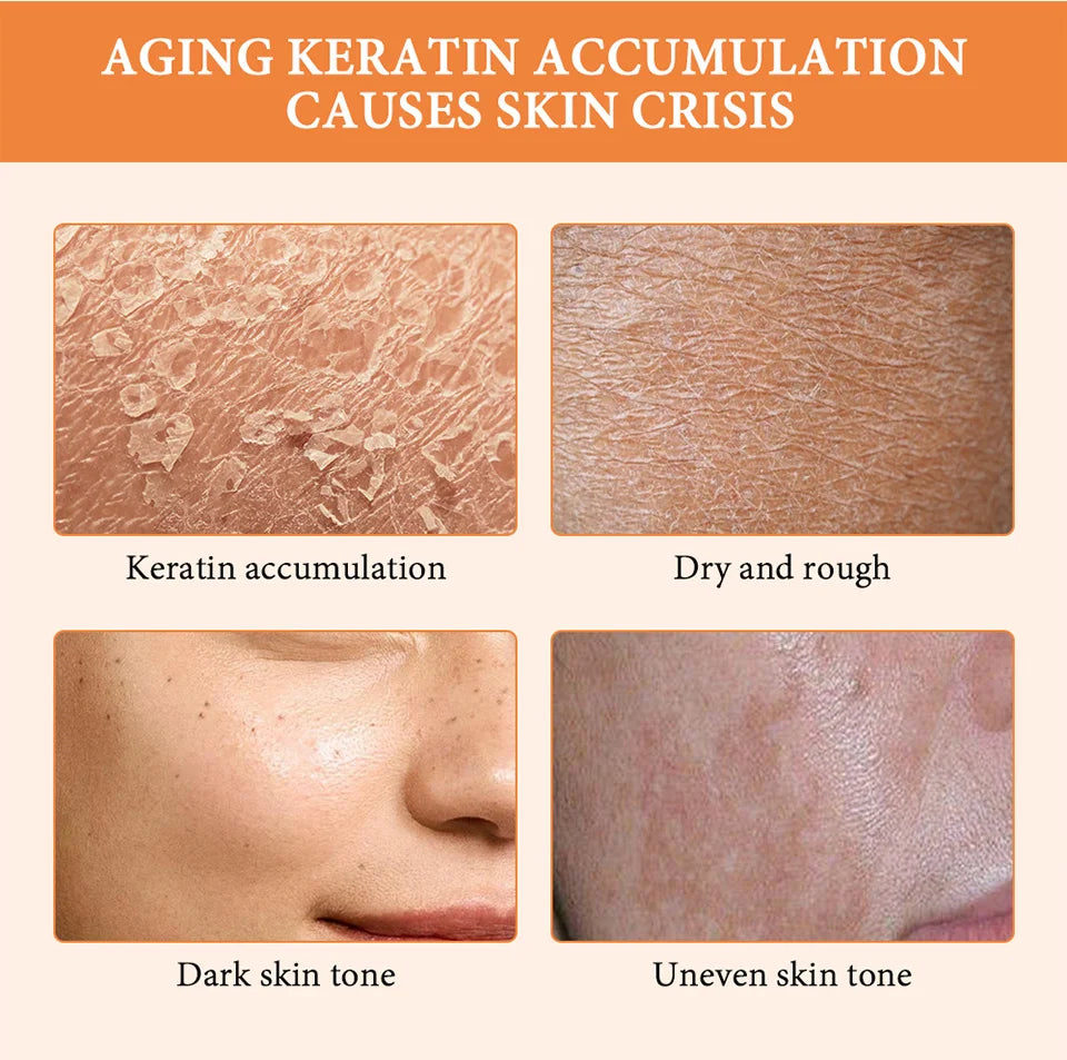 Orange Peeling Gel Scrub