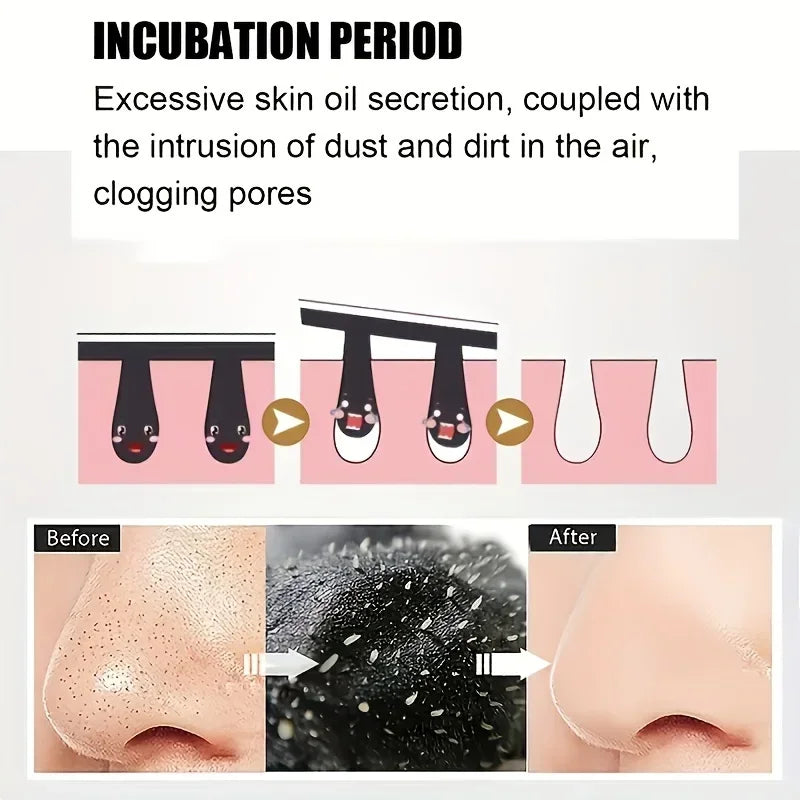 15pcs Deep Cleansing Blackhead Nose Strips